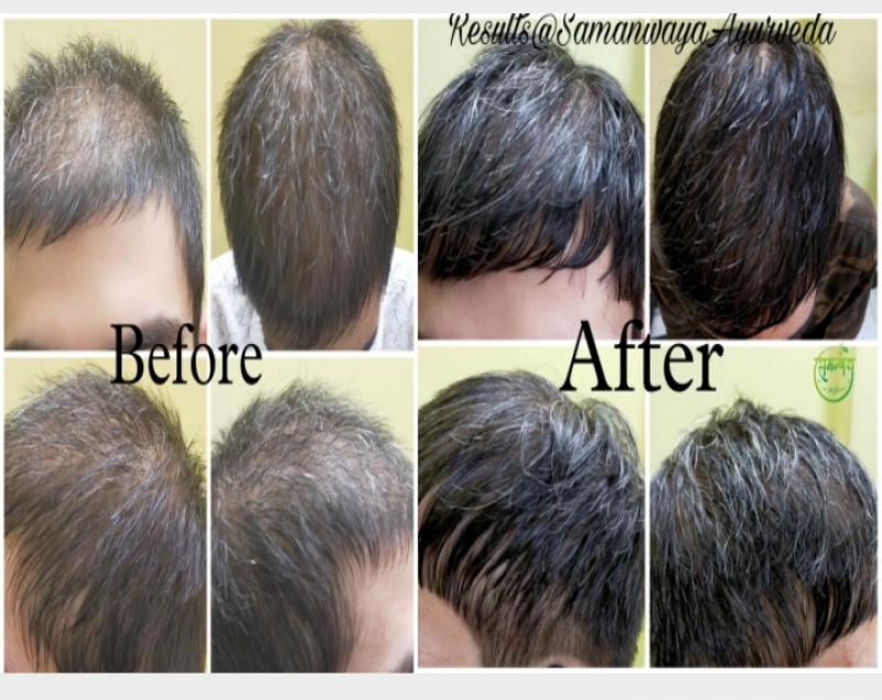 Results in hair thinning and greying